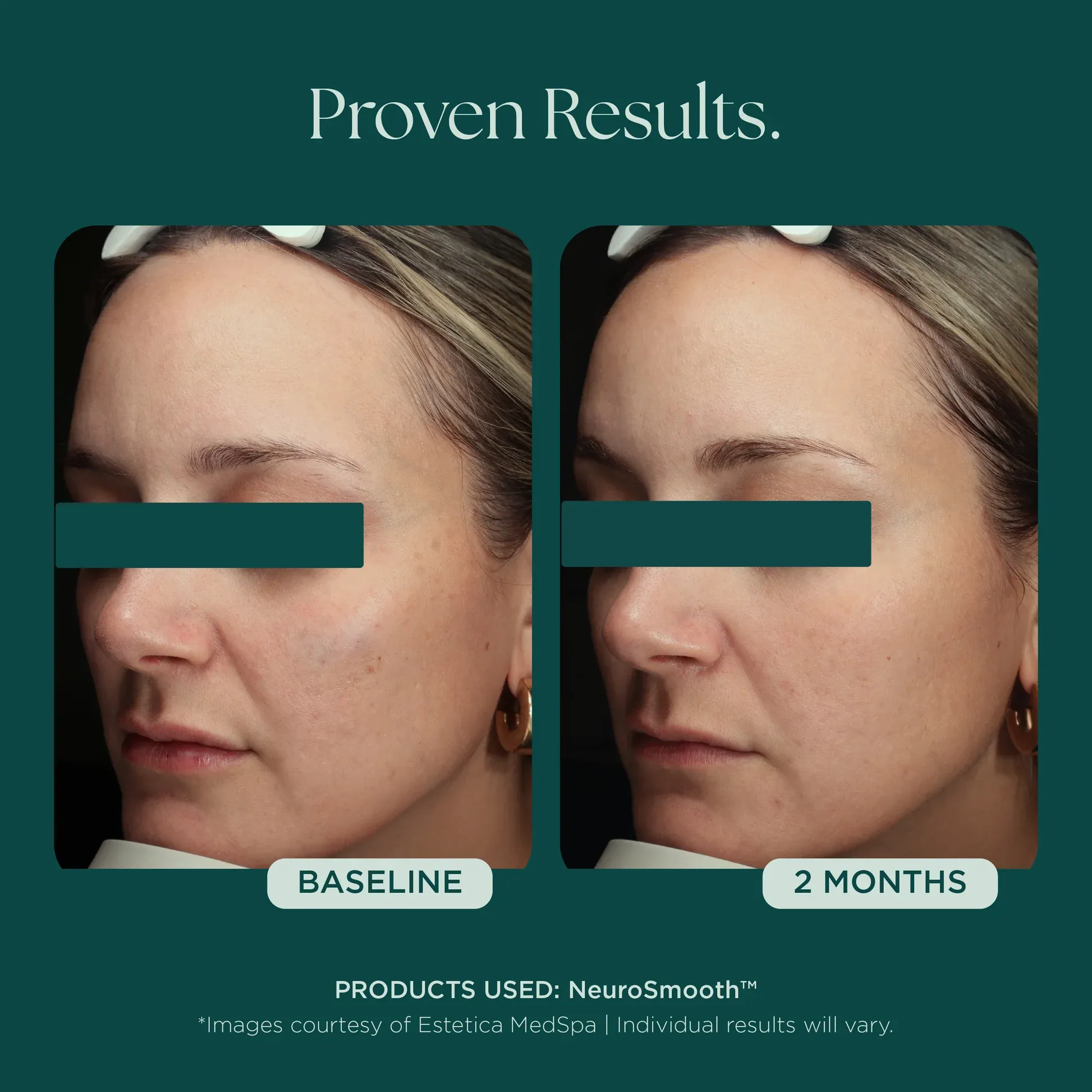 Facial improvement comparison image