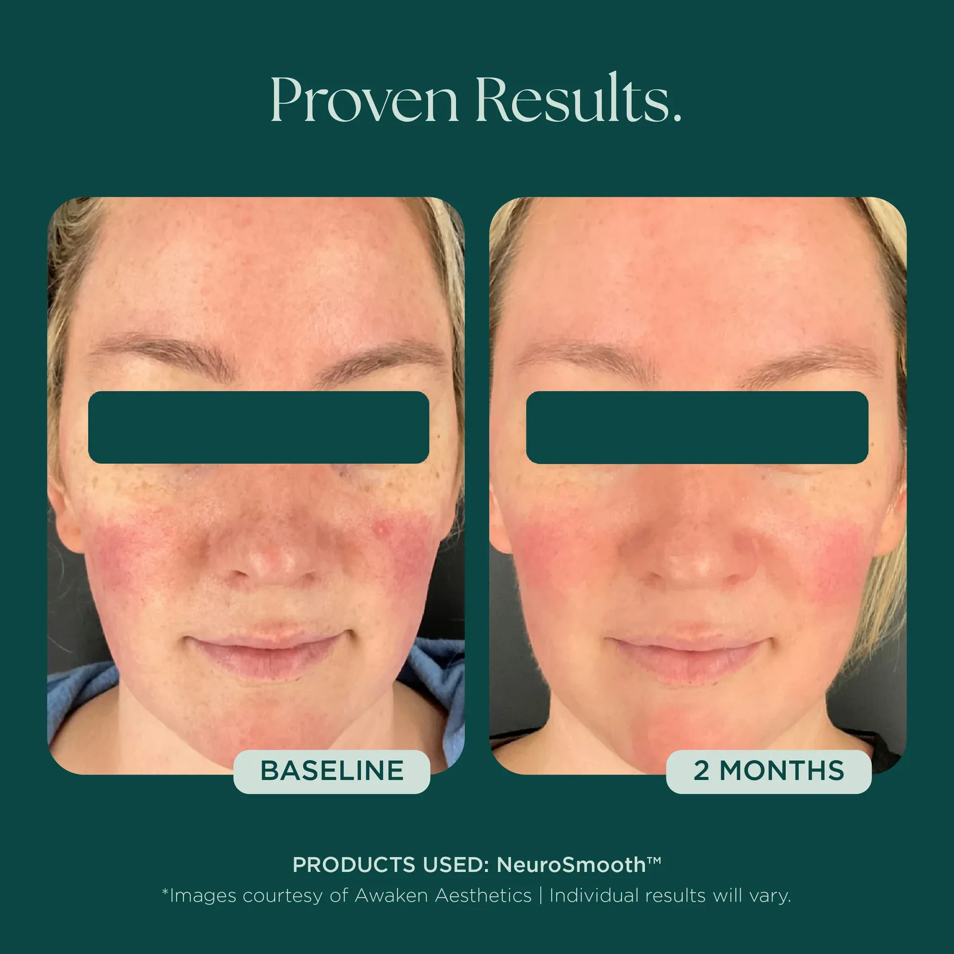 Skincare results comparison