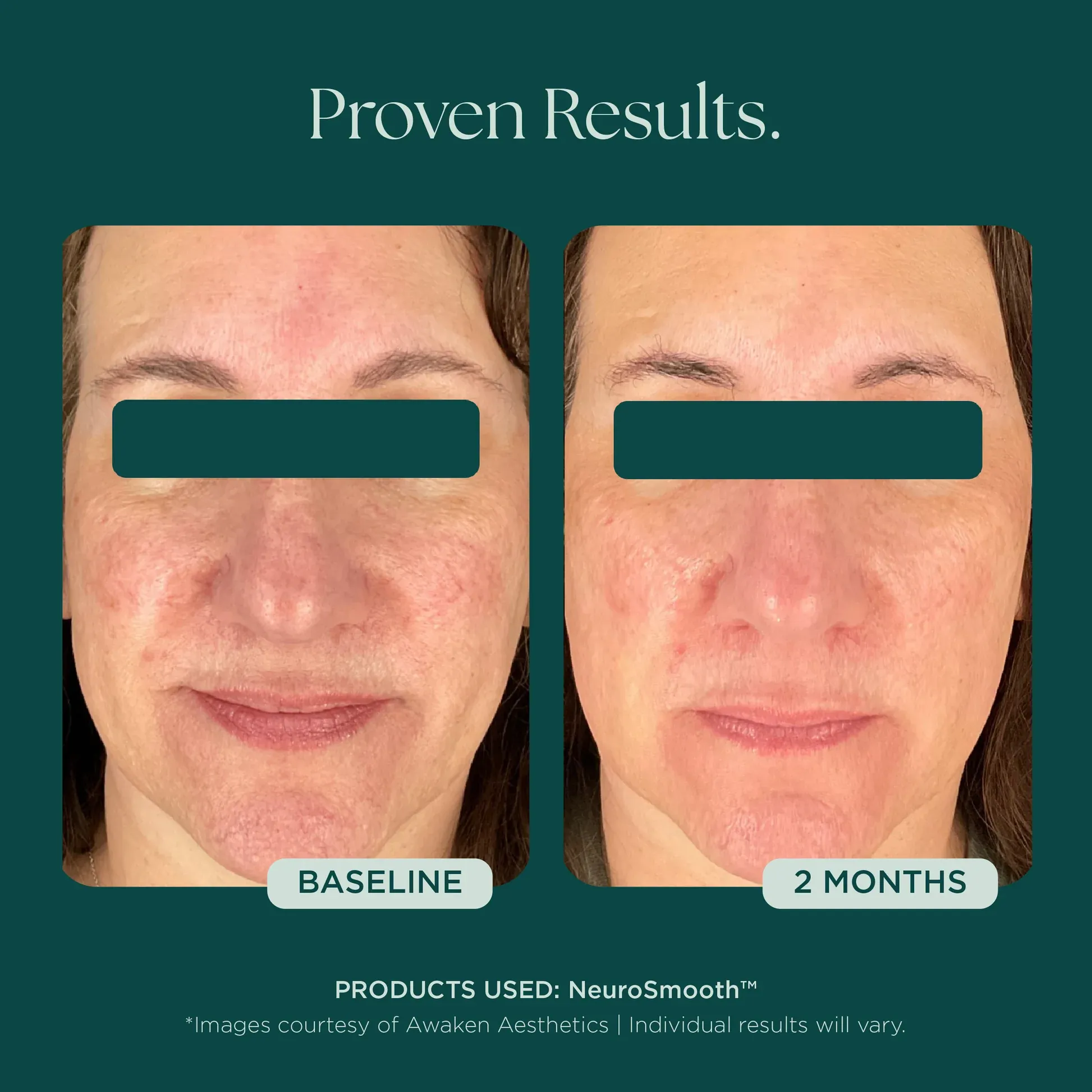 Skincare results comparison before and after