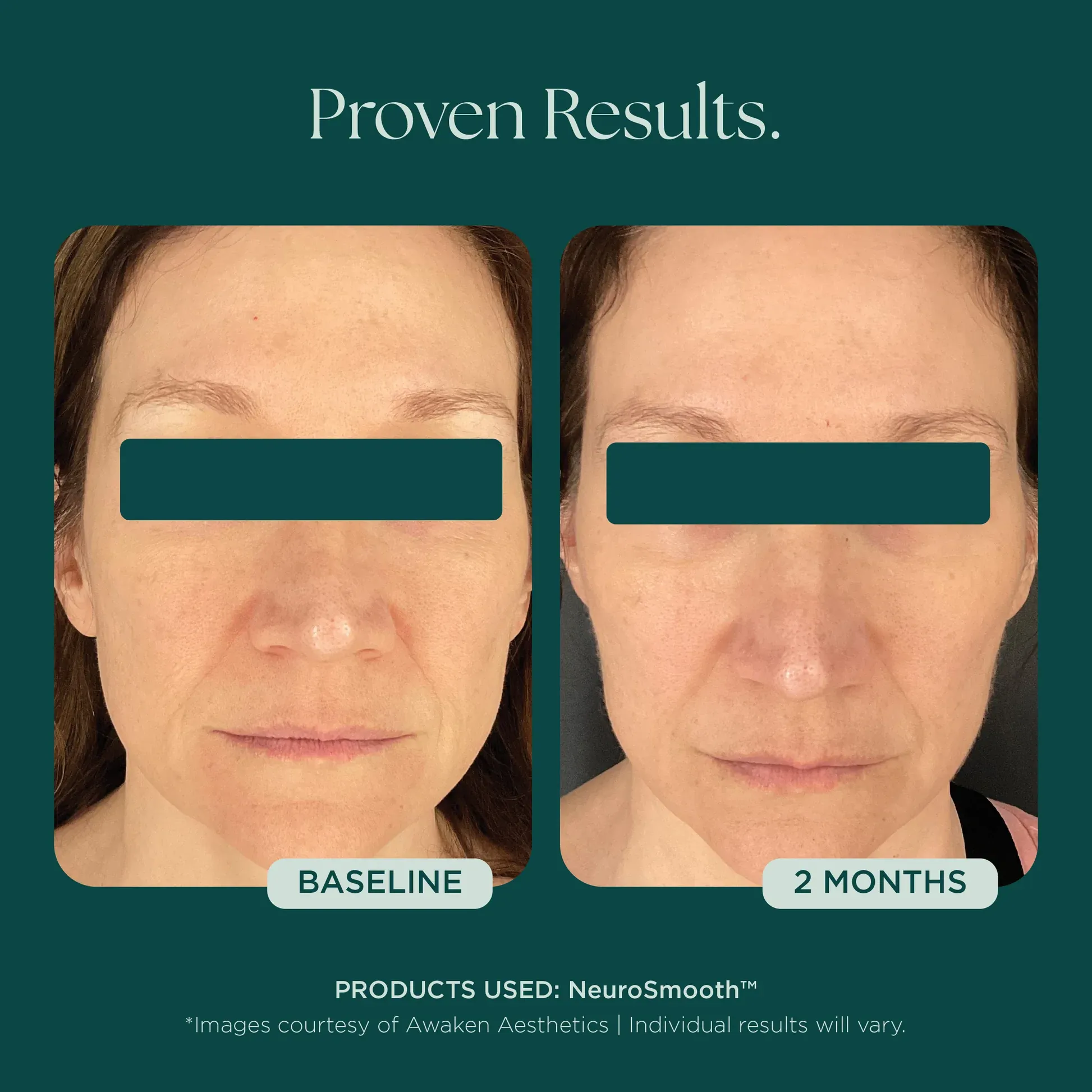 Facial improvement over two months