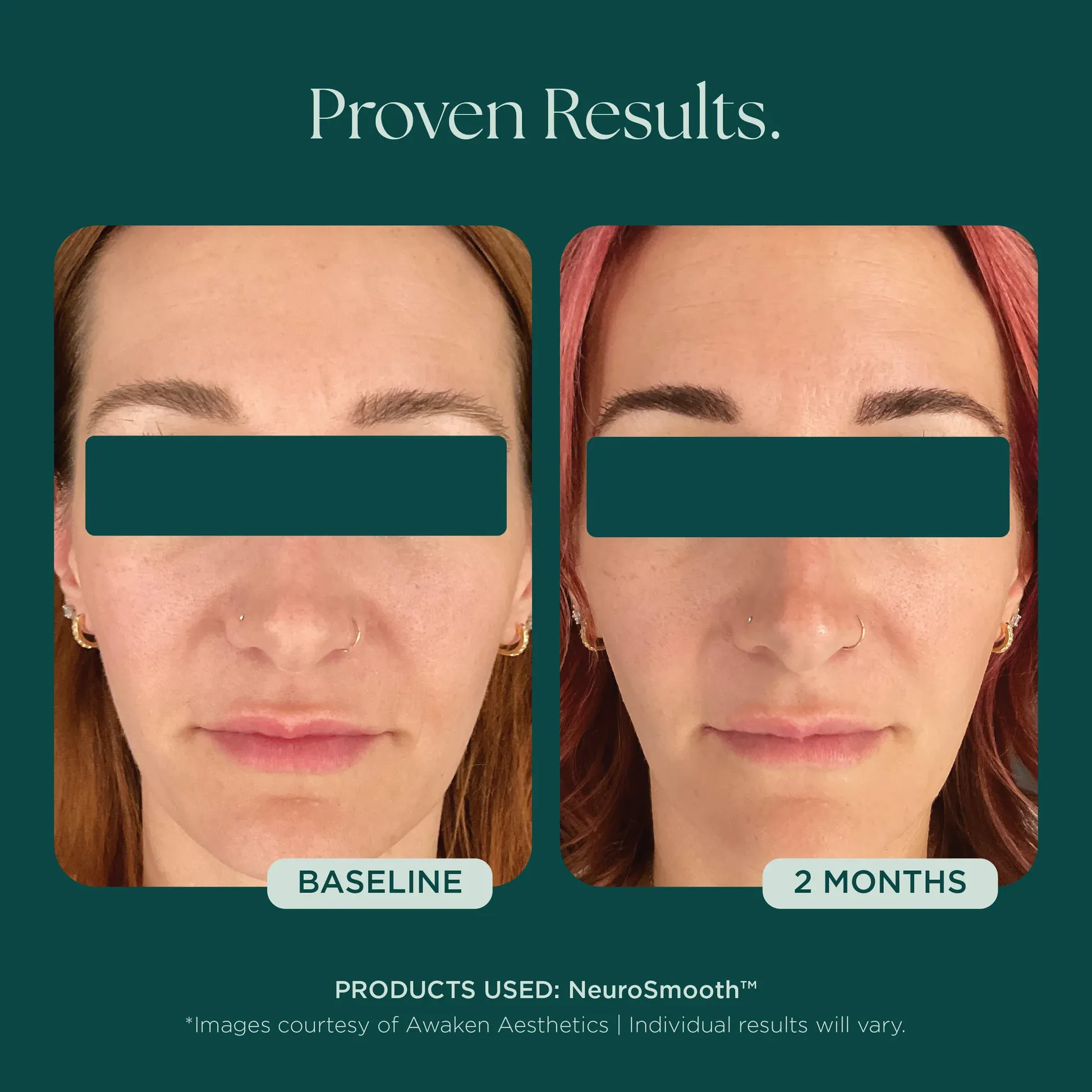 Before and after skincare results