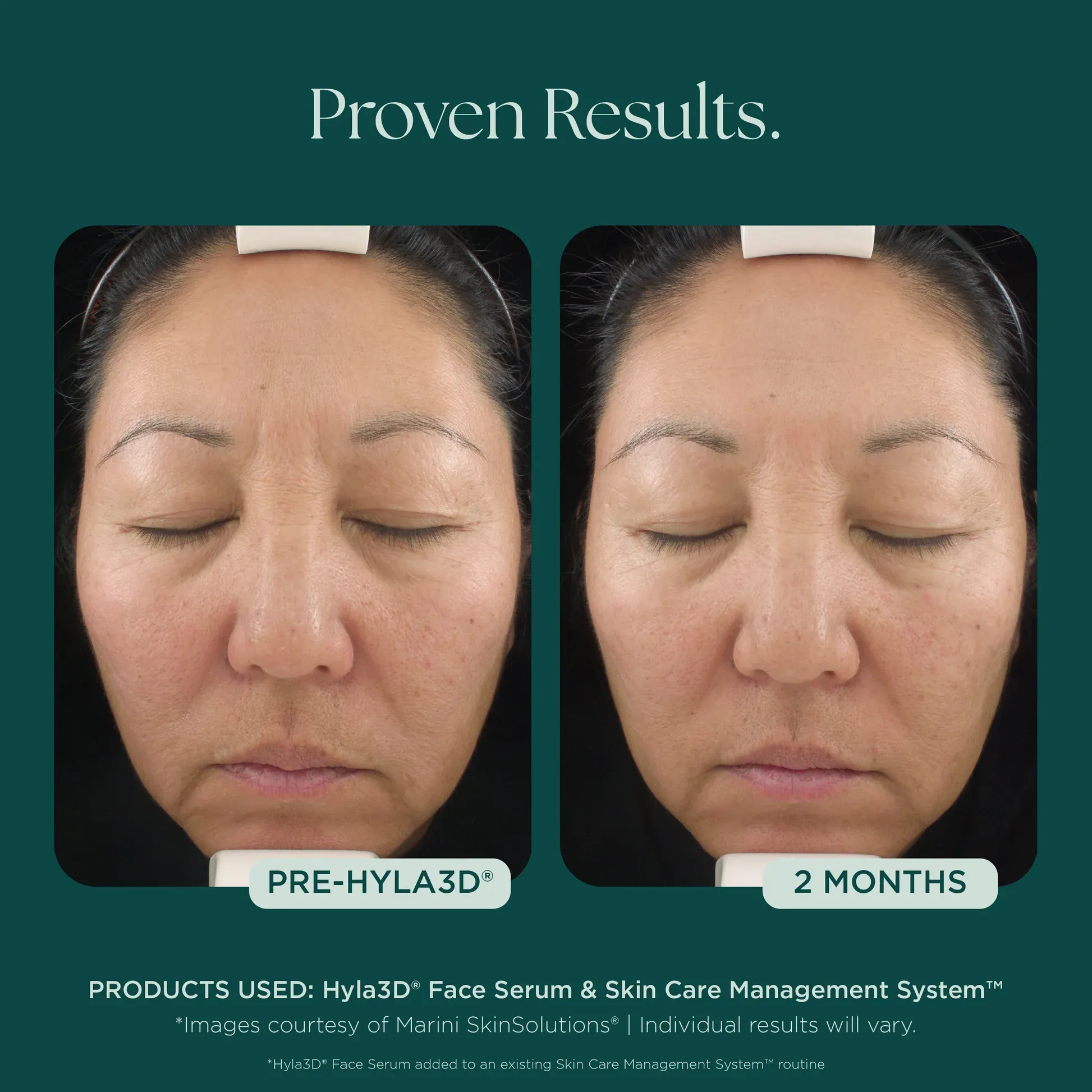 Before and after skincare results
