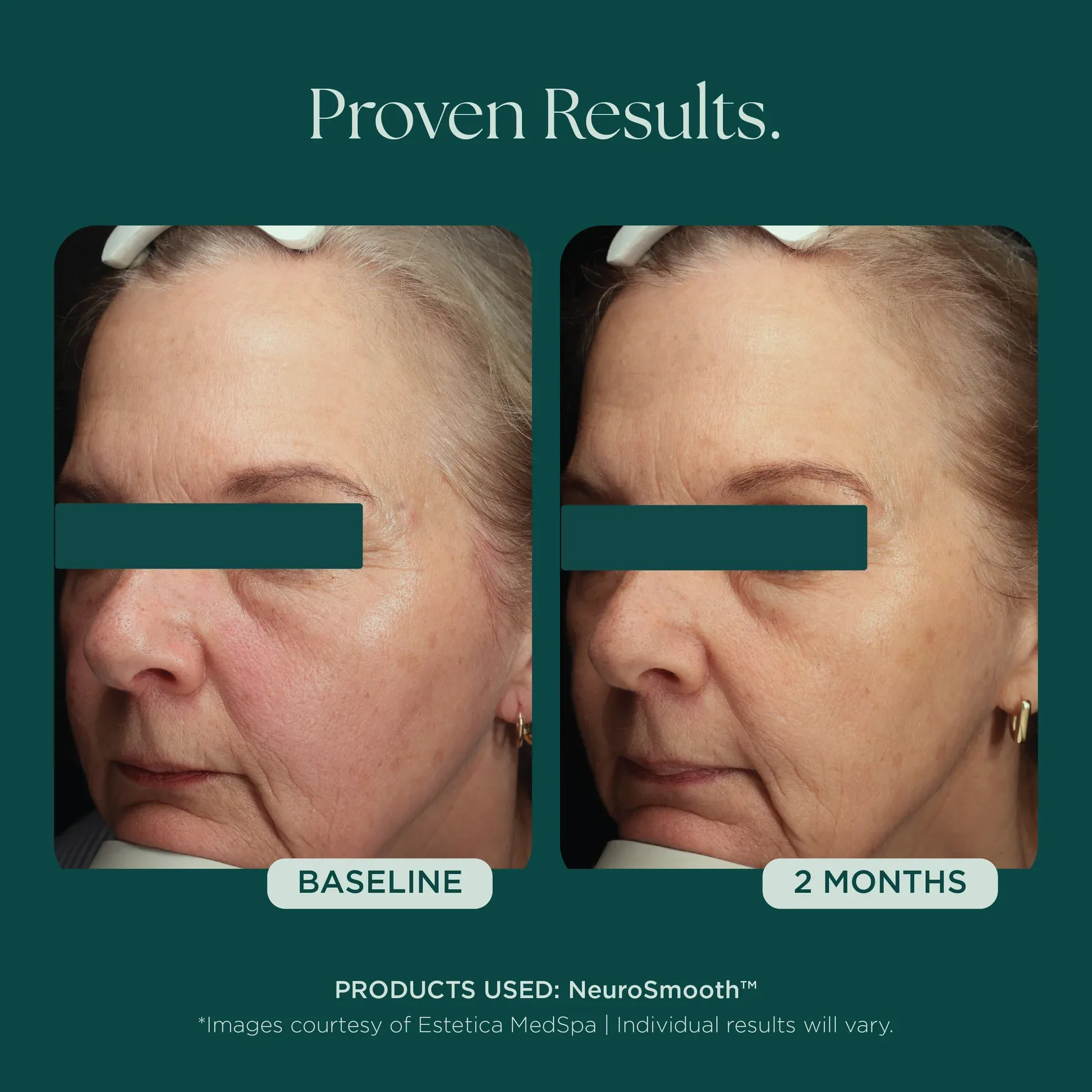 Two-month skincare transformation