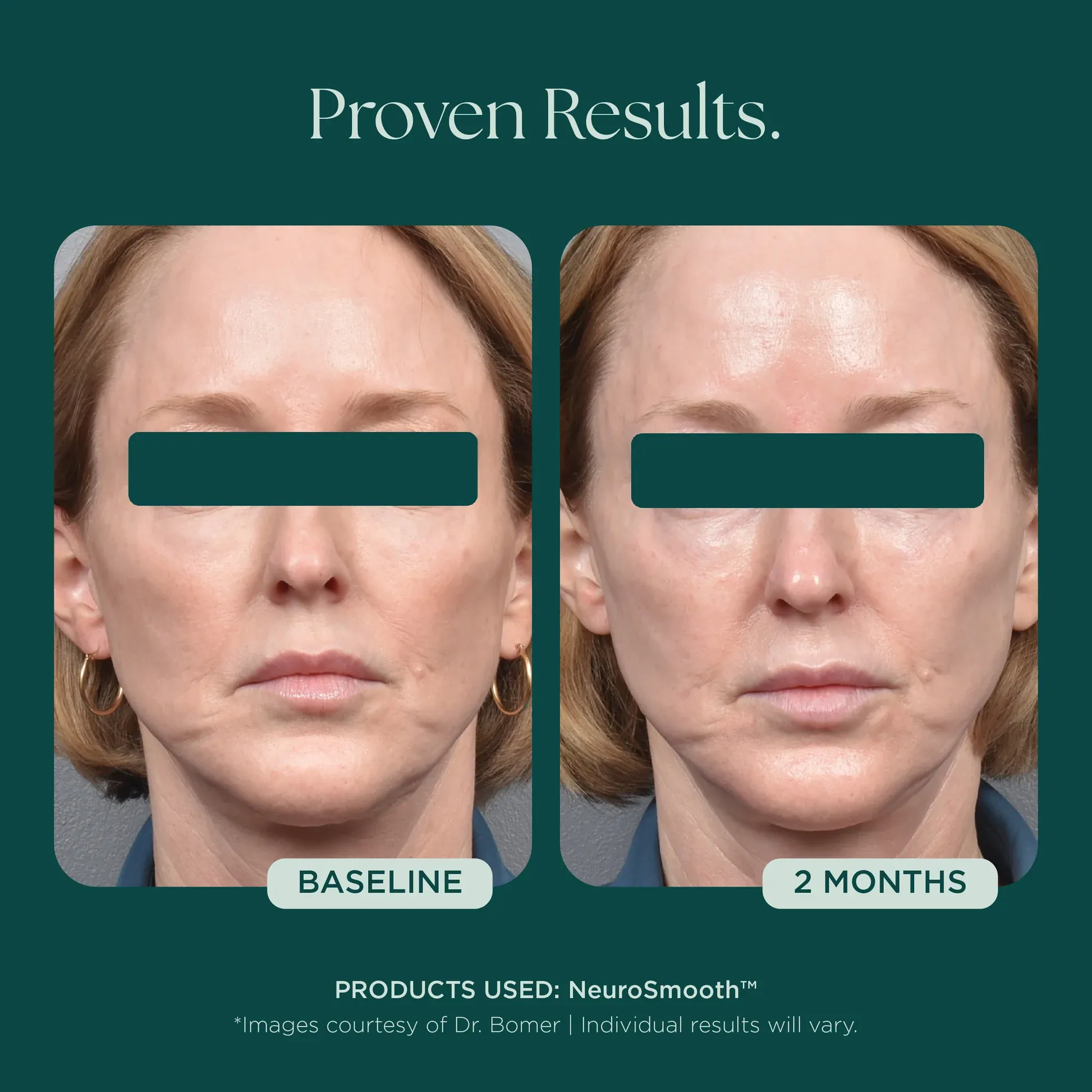Facial improvement in two-month period