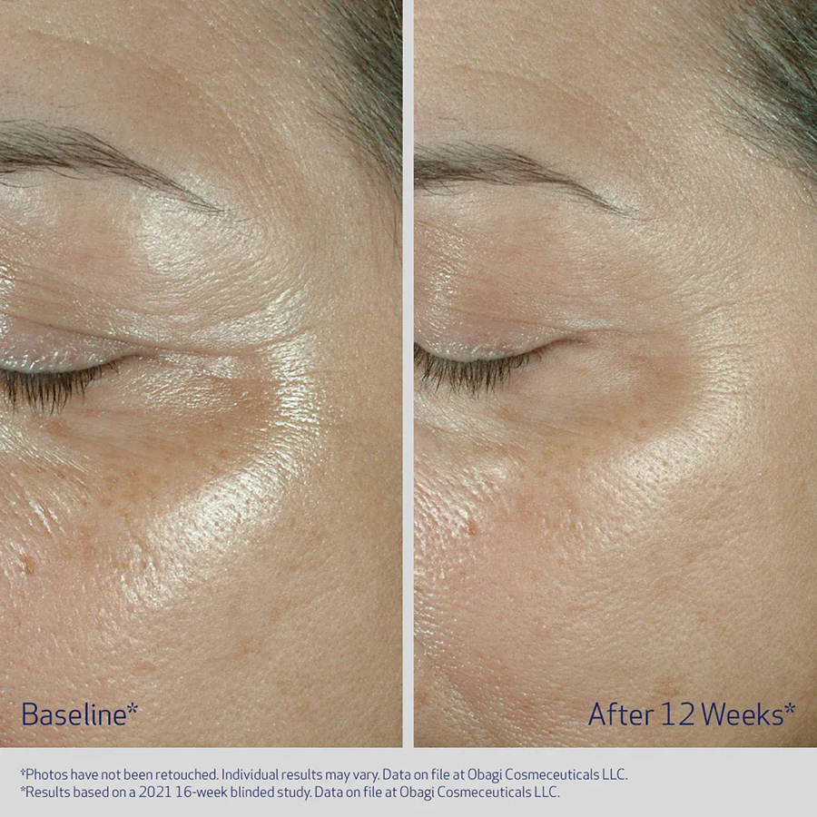 Skin texture improvement over 12 weeks