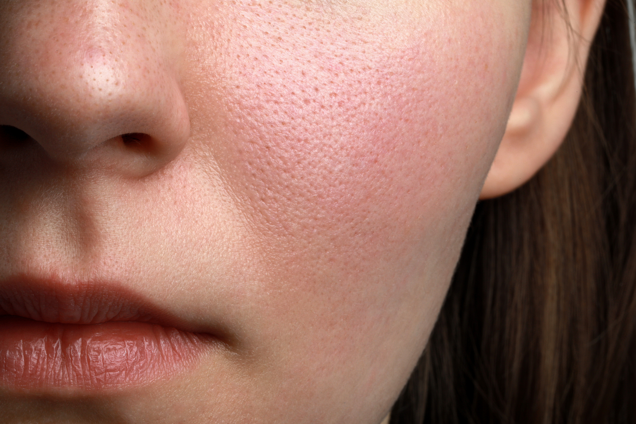 Closeup view of woman with normal skin
