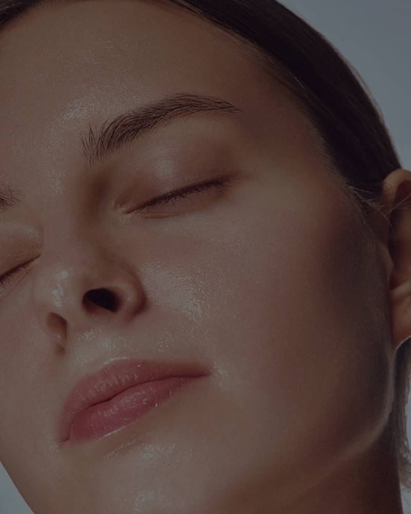 Skin With Expression and Dramatic Lines, Loss of Tonicity