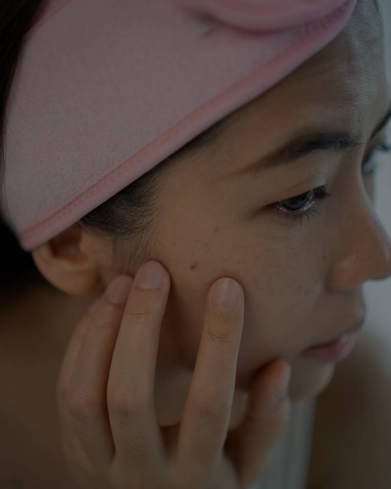 Skin With Pigmentation and Sun Damage